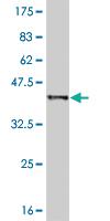 Anti-PTK2B Mouse Monoclonal Antibody [clone: 1F9]