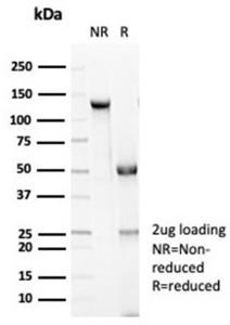 SDS-PAGE analysis of Anti-E Cadherin Antibody [CDH1/7034R] under non-reduced and reduced conditions; showing intact IgG and intact heavy and light chains, respectively SDS-PAGE analysis confirms the integrity and purity of the antibody