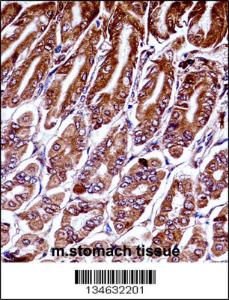 Anti-MAP3K7 Rabbit Polyclonal Antibody (Biotin)