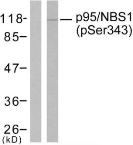 Anti-p95/NBS1