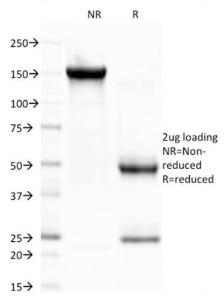 SDS-PAGE analysis of Anti-CELA3B Antibody [CELA3B/1757] under non-reduced and reduced conditions; showing intact IgG and intact heavy and light chains, respectively. SDS-PAGE analysis confirms the integrity and purity of the antibody