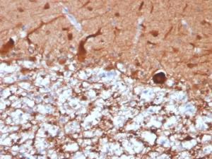 Immunohistochemical analysis of formalin-fixed, paraffin-embedded human cerebellum using Anti-PGP9.5 Antibody [UCHL1/4556R]