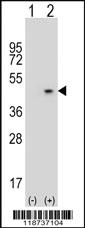 Anti-AZGP1 Rabbit Polyclonal Antibody