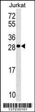 Anti-ANP32C Rabbit Polyclonal Antibody (AP (Alkaline Phosphatase))