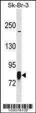 Anti-LIMK1 Rabbit Polyclonal Antibody (AP (Alkaline Phosphatase))