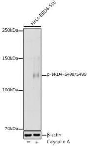 Western blot analysis of extracts of HeLa cells, using Anti-Brd4 (phospho Ser498 + Ser499) Antibody (A308618) at 1:1,000 dilutio