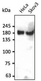 Endogenous INSR detected with Anti-INSR Antibody at a 1:2,500 dilution. Lysates at 50 µg per lane and rabbit anti-goat IgG antibody (HRP) at a 1:10,000 dilution