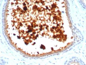 Immunohistochemical analysis of formalin-fixed, paraffin-embedded human lactating breast using Anti-Mammaglobin A Antibody [MGB/4811R]