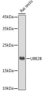 Anti-Ube2B antibody