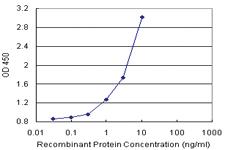 Anti-AIPL1 Antibody Pair