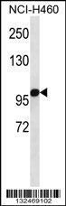 Anti-OGDH Rabbit Polyclonal Antibody (FITC (Fluorescein Isothiocyanate))