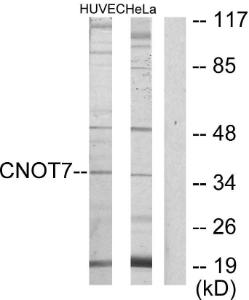 Western blot analysis of lysates from HeLa and HUVEC cells using Anti-CNOT7 Antibody The right hand lane represents a negative control, where the antibody is blocked by the immunising peptide