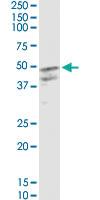 Anti-CSF2 Mouse Monoclonal Antibody [clone: 2G9]