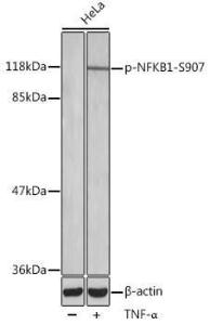 Western blot analysis of extract from HeLa cells, using Anti-NFkB p105 / p50 (phospho Ser907) Antibody (A10946). The secondary antibody was Goat Anti-Rabbit IgG H&L Antibody (HRP) at 1:10,000 dilution. Lysates/proteins were present at 25µg per lane. The blocking buffer used was 3% BSA.