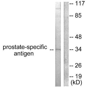 Western blot analysis of lysates from mouse heart cells using Anti-Prostate-specific Antigen Antibody. The right hand lane represents a negative control, where the antibody is blocked by the immunising peptide.