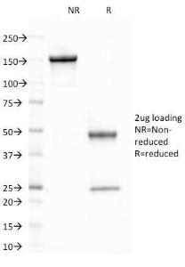 SDS-PAGE analysis of Anti-CELA3B Antibody [CELA3B/1758] under non-reduced and reduced conditions; showing intact IgG and intact heavy and light chains, respectively. SDS-PAGE analysis confirms the integrity and purity of the antibody