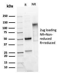 SDS-PAGE analysis of Anti-Mammaglobin A Antibody [MGB/4811R] under non-reduced and reduced conditions; showing intact IgG and intact heavy and light chains, respectively. SDS-PAGE analysis confirms the integrity and purity of the antibody