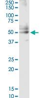 Anti-CSF2 Mouse Monoclonal Antibody [clone: 1D6]