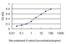 Anti-SMARCB1 Mouse Monoclonal Antibody [clone: 3E10]