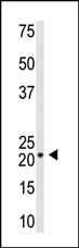 Anti-VSNL1 Rabbit Polyclonal Antibody