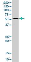 Anti-MYCN Rabbit Polyclonal Antibody