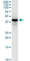 Anti-SMARCB1 Mouse Monoclonal Antibody [clone: 3E3]