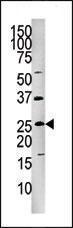 Anti-FADD Rabbit Polyclonal Antibody (HRP (Horseradish Peroxidase))