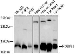 Western blot analysis of extracts of various cell lines, using Anti-NDUFS5 Antibody (A307601) at 1:1000 dilution. The secondary Antibody was Goat Anti-Rabbit IgG H&L Antibody (HRP) at 1:10000 dilution. Lysates/proteins were present at 25 µg per lane