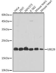 Anti-Ube2B antibody