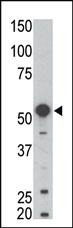 Anti-BLK Rabbit Polyclonal Antibody