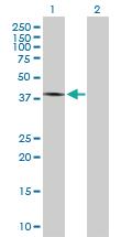 Anti-MYCN Rabbit Polyclonal Antibody