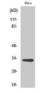 Western blot analysis of various cells using Anti-CNOT7 Antibody