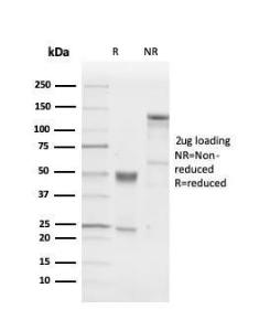 SDS-PAGE analysis of Anti-PGP9.5 Antibody [UCHL1/4556R] under non-reduced and reduced conditions; showing intact IgG and intact heavy and light chains, respectively. SDS-PAGE analysis confirms the integrity and purity of the antibody.