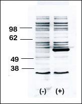 Anti-BLK Rabbit Polyclonal Antibody