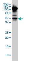 Anti-MYCN Mouse Monoclonal Antibody [clone: 3H4]