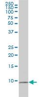 Anti-RPS27A Mouse Monoclonal Antibody [clone: 3E2-E6]