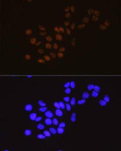 Immunofluorescence analysis of HeLa cells using Anti-METTL3 Antibody [ARC0487] (A308621) at a dilution of 1:100 (40x lens). DAPI was used to stain the cell nuclei (blue)