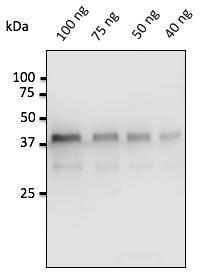 40-100ng of pepsin, isolated from porcine gastric mucosa, detected with Anti-Pepsin Antibody at a 1:500 dilution. Rabbit anti-goat IgG antibody (HRP) was used at a 1:10,000 dilution.