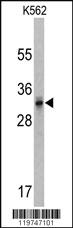 Anti-CACNG5 Rabbit Polyclonal Antibody