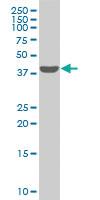 Anti-SMARCB1 Mouse Monoclonal Antibody [clone: 3E3]