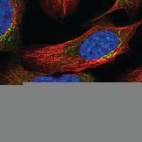 Anti-ASCC2 Rabbit Polyclonal Antibody