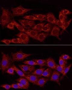 Immunofluorescence analysis of NIH/3T3 cells using Anti-NDUFS5 Antibody (A307601) at a dilution of 1:100 (40X lens). DAPI was used to stain the cell nuclei (blue)