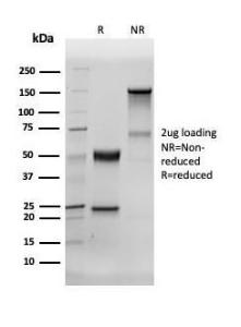 Anti-Human Nuclear Antigen antibody