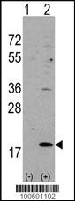 Anti-HPCAL1 Rabbit Polyclonal Antibody