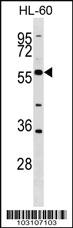 Anti-BLK Rabbit Polyclonal Antibody