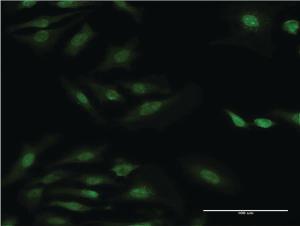 Anti-RPS29 Mouse Monoclonal Antibody [clone: 3G9]