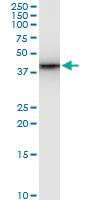 Anti-SMARCB1 Mouse Monoclonal Antibody [clone: 3E3]