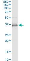 Anti-SCP2 Antibody Pair