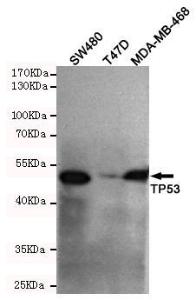 Anti-TP53 Mouse Monoclonal Antibody [clone: 13k93]