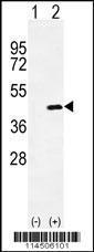 Anti-OGN Rabbit Polyclonal Antibody (AP (Alkaline Phosphatase))